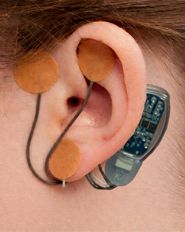 IB-Stim_device3a IB-Stim Device